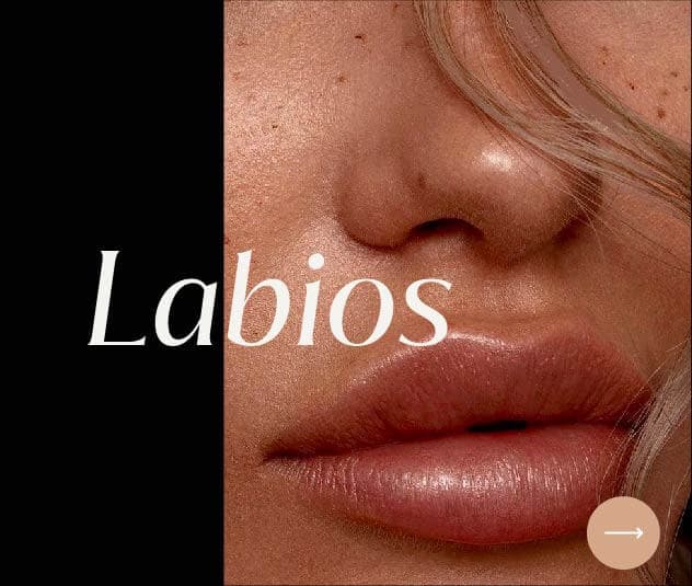 Labios: tratamiento del Dr. Jhonatan Valencia